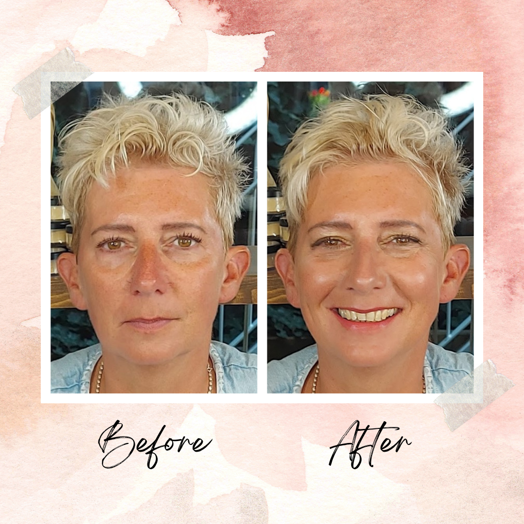 Frisse Make-over voor Rosacea: Jeanet’s Stralende Transformatie